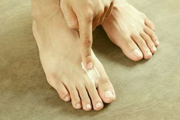 Use toenail fungus cream